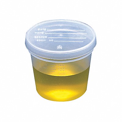 GLOBE SCIENTIFIC 5917 Specimen Container 147mL 67.5 mm H PK300